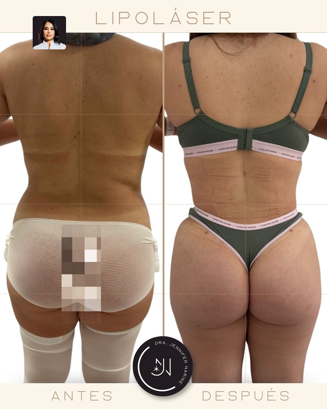 489824077_18371509459193391_3711964432399216525_n