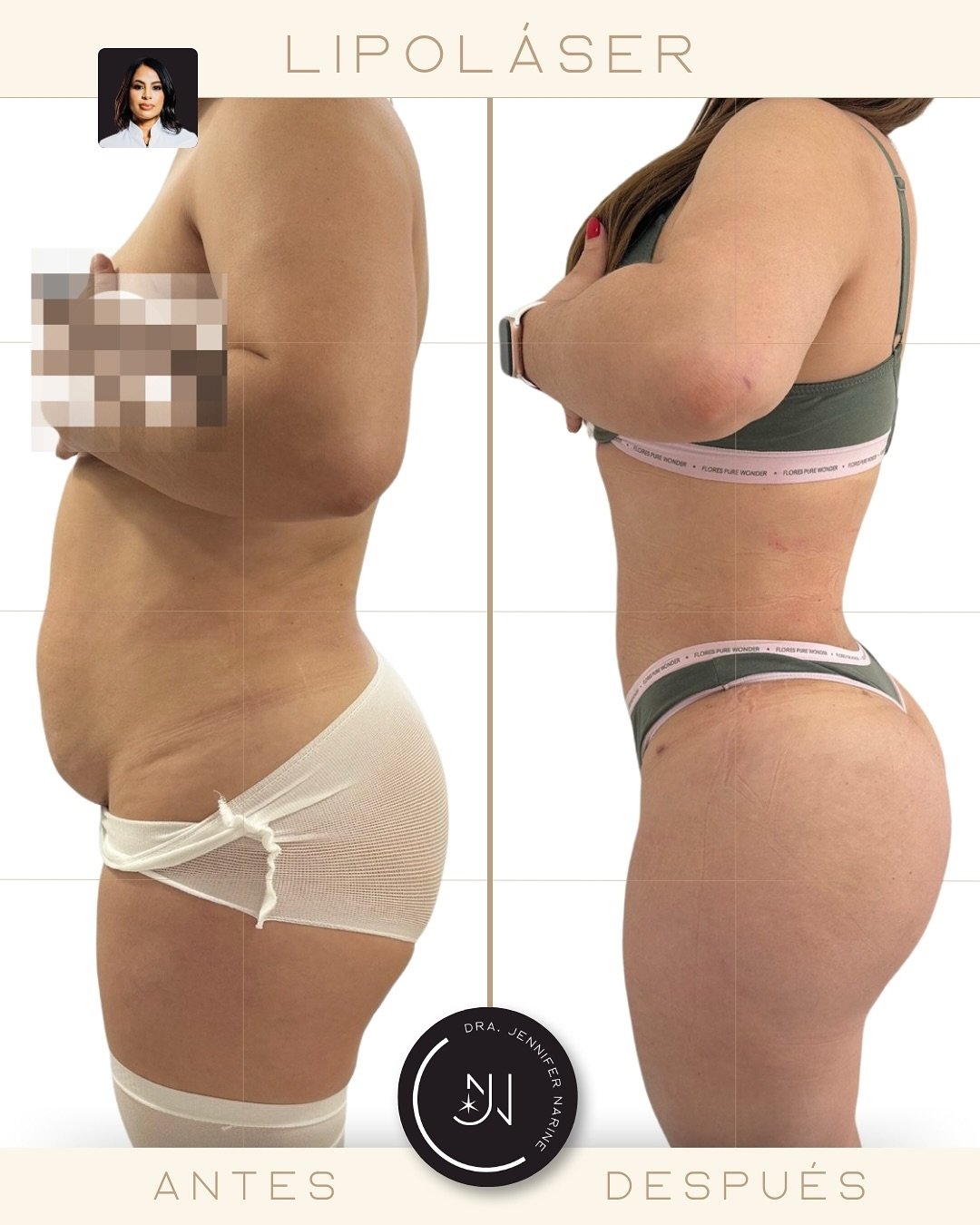 490444531_18371509408193391_1124711837683365578_n