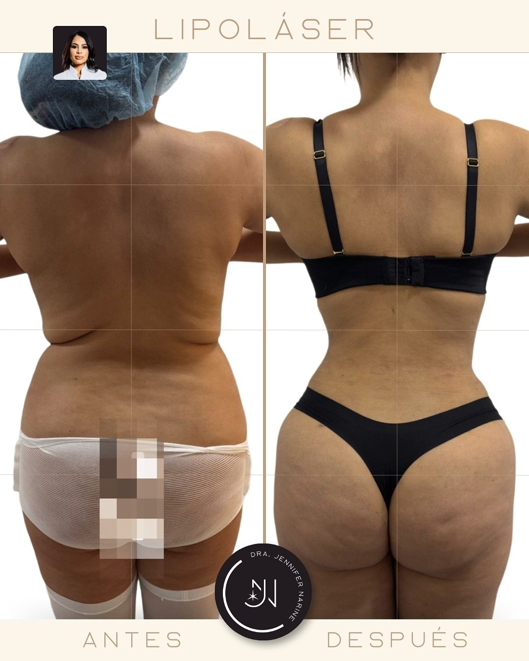 496824637_18375083227193391_8013629087715433059_n