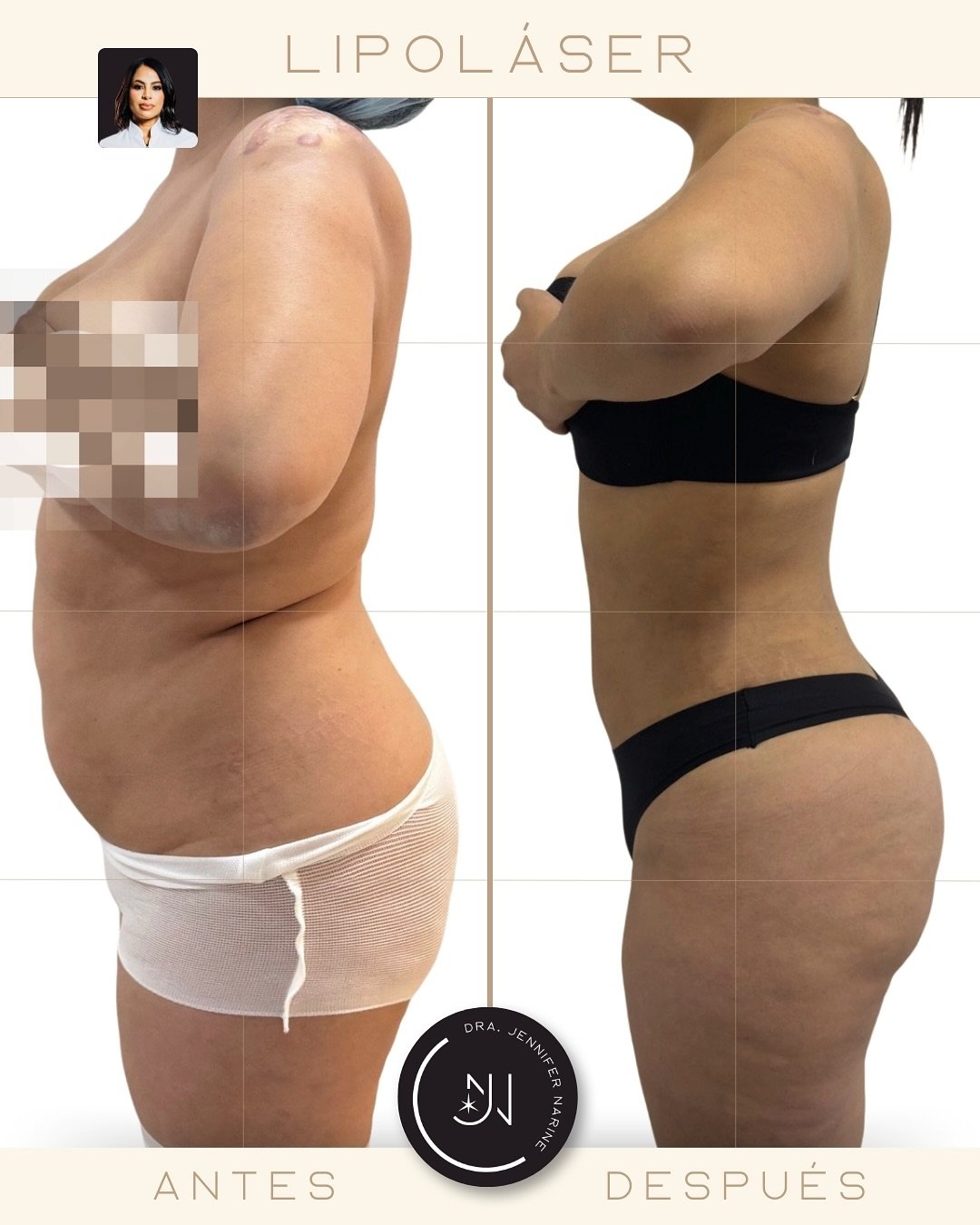 496925159_18375083242193391_7009214502179746049_n