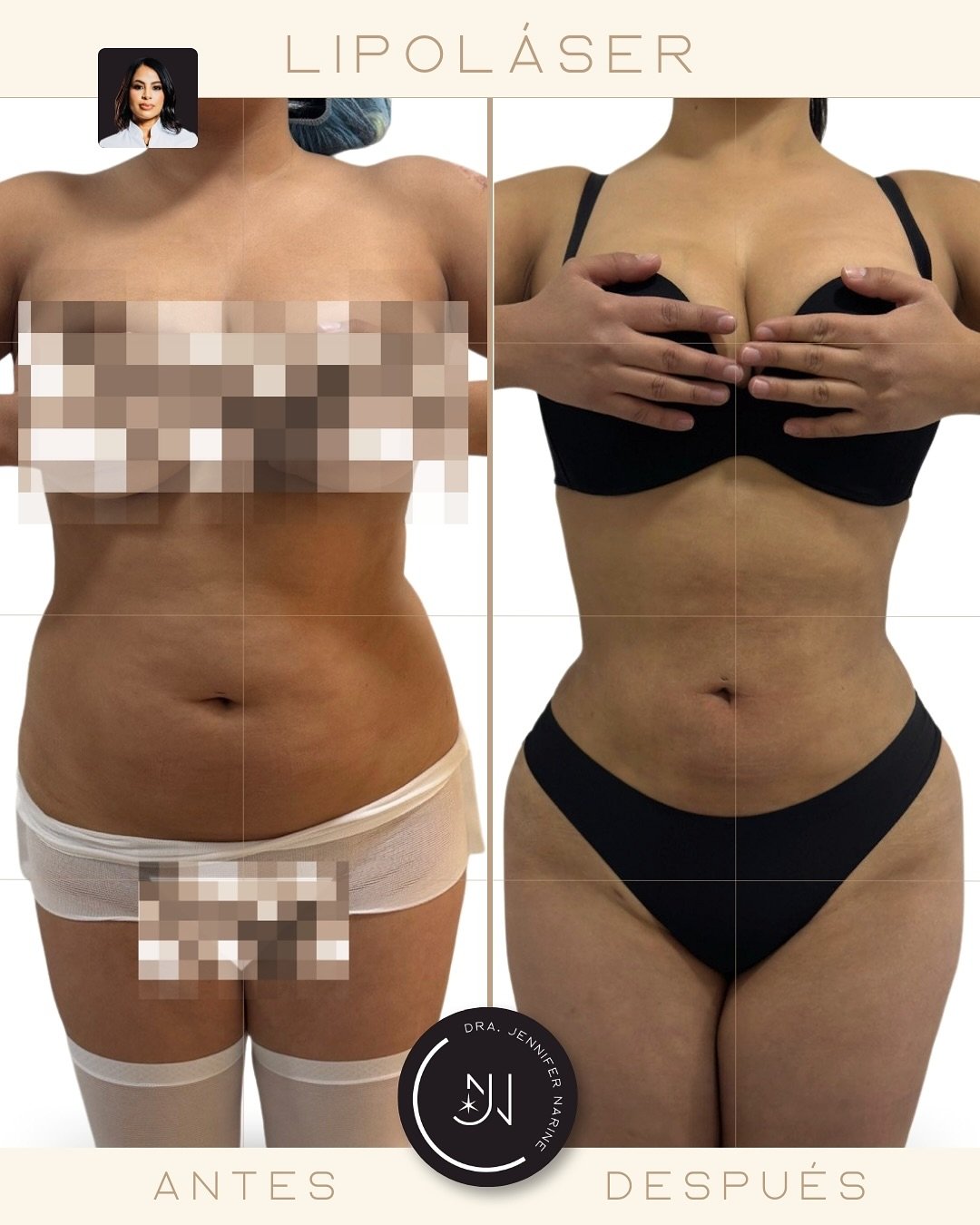 496963094_18375083245193391_1895313395232959895_n