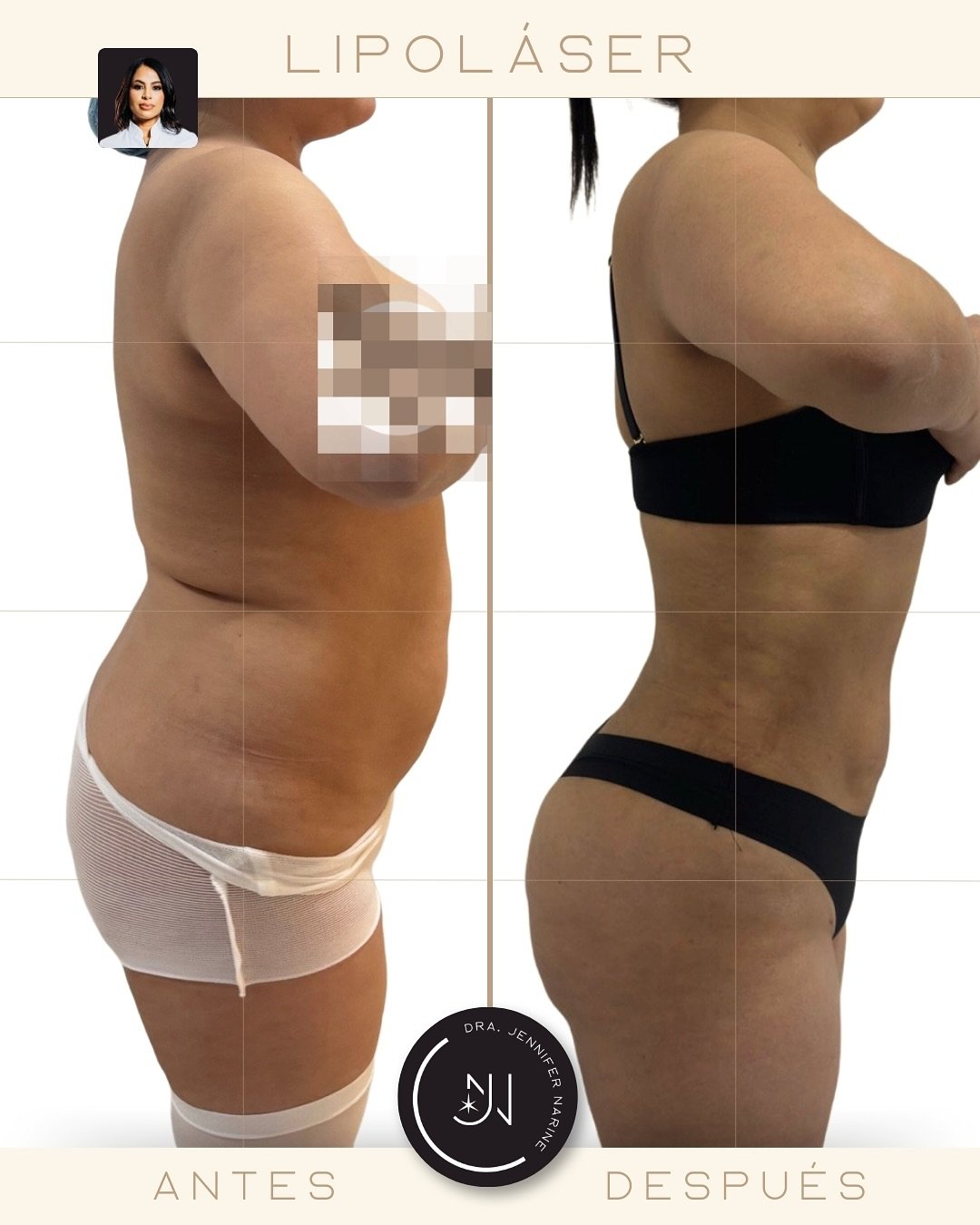 497505554_18375083221193391_8178818432977448187_n