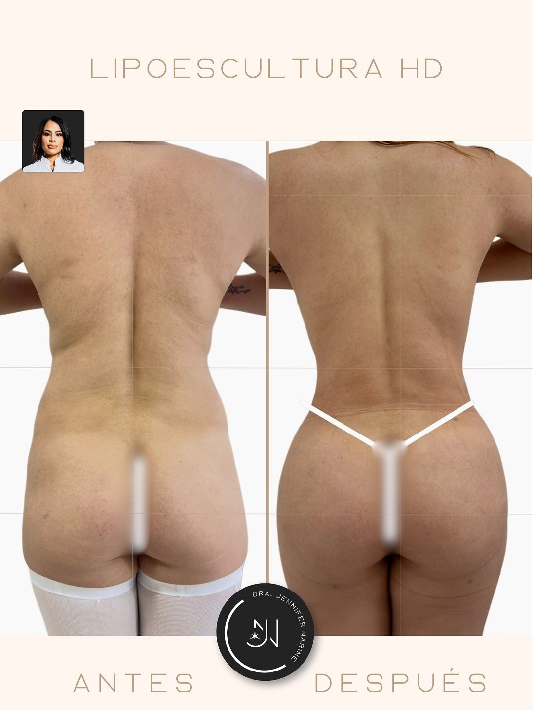 588911209_18404988964193391_4987829796579554865_n