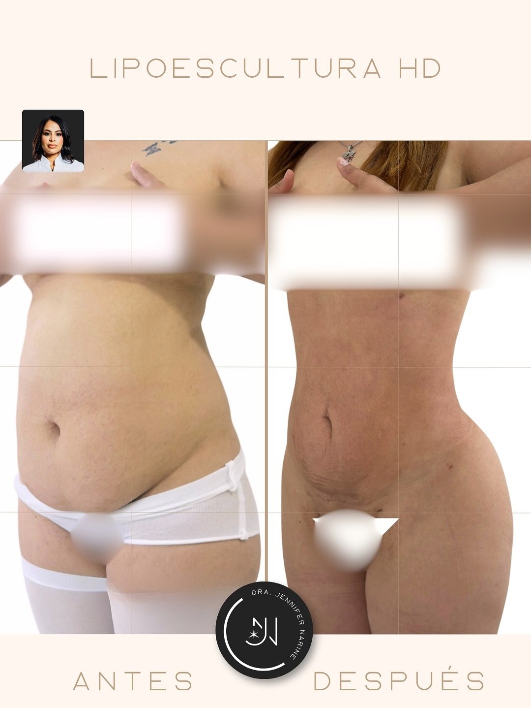 600338562_18404988946193391_8741308773698130831_n